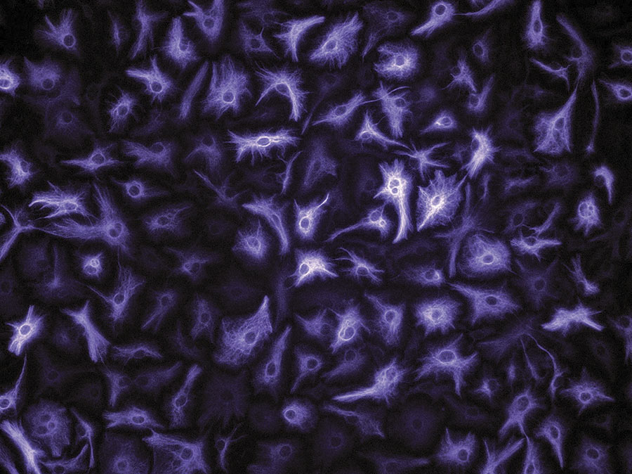 The skeletons of star-shaped cells in the brain called astrocytes, visualized here with fluorescent probes, making them purple.